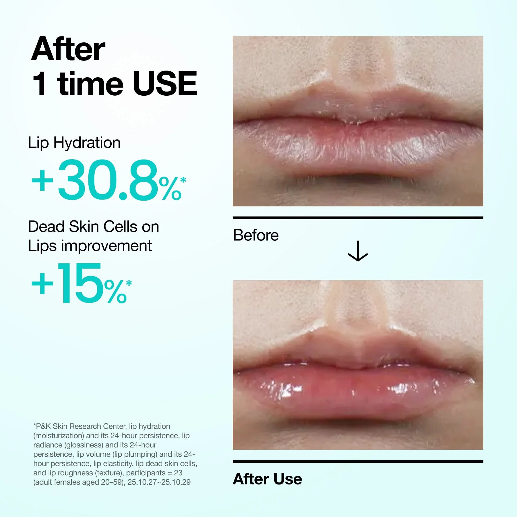Anua US PDRN Lip Serum PDRN Lip Serum