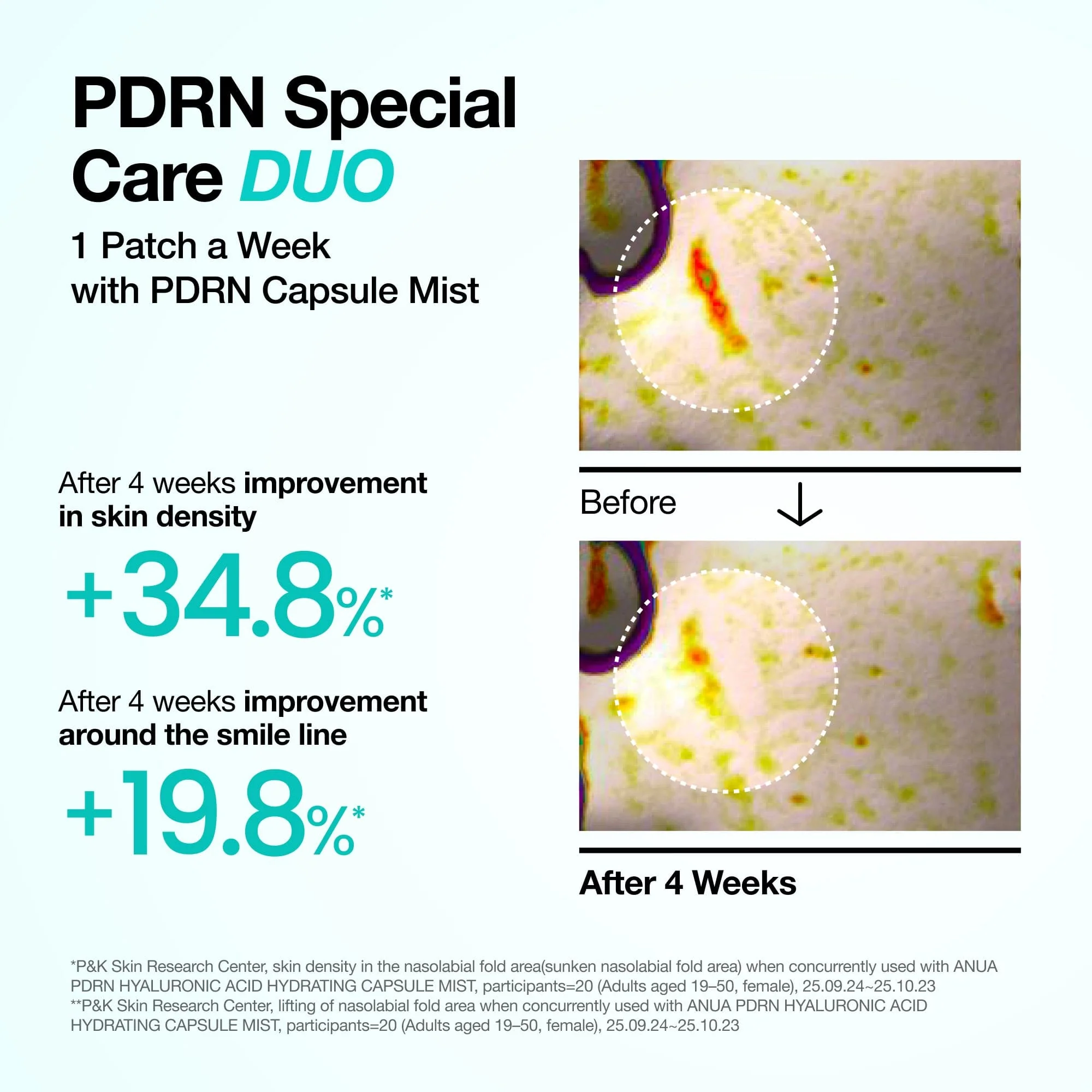 Anua US Spot Patches PDRN COLLAGEN MELTING PATCH FOR GLASS SKIN 4ea